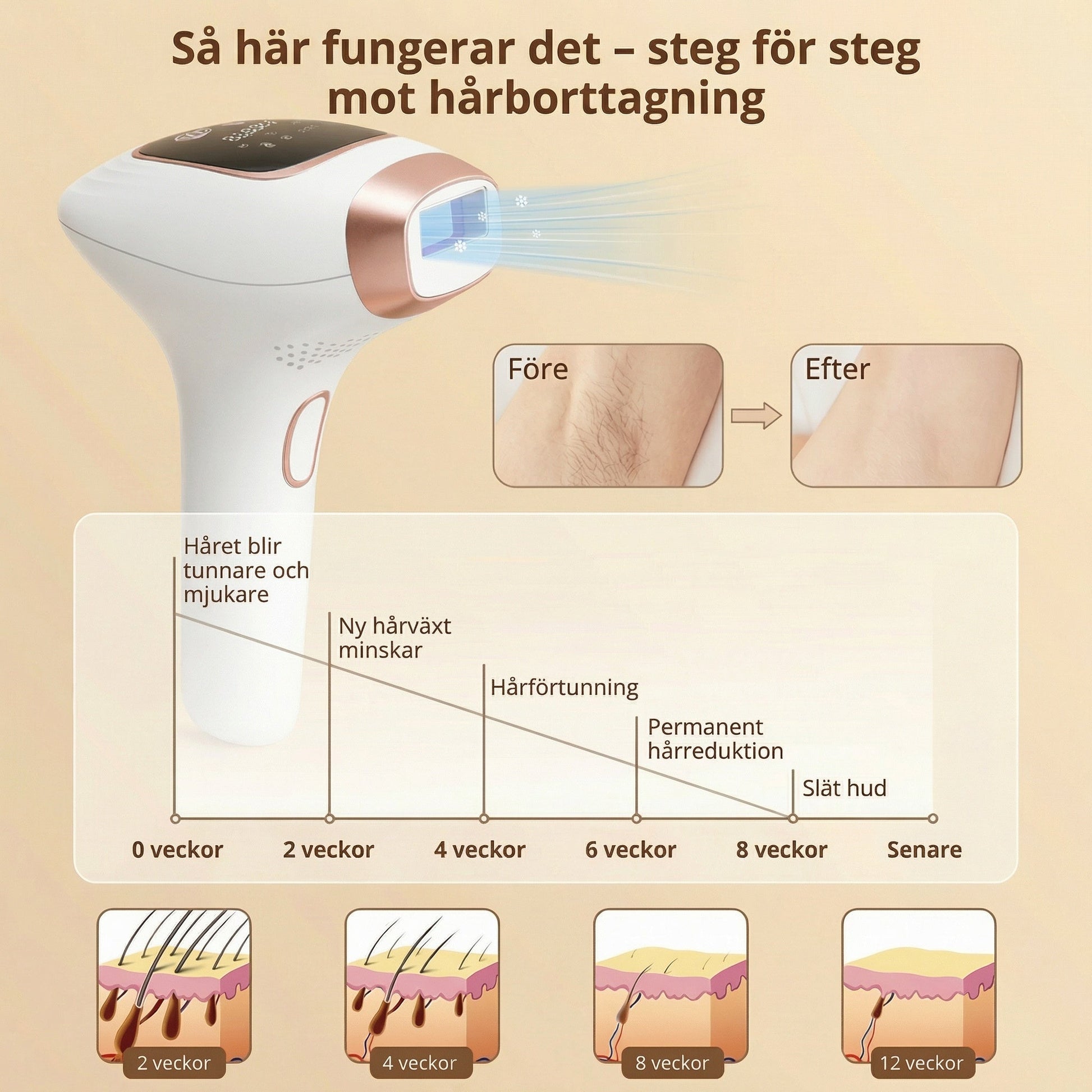 Så fungerar IPL hårborttagning steg för steg