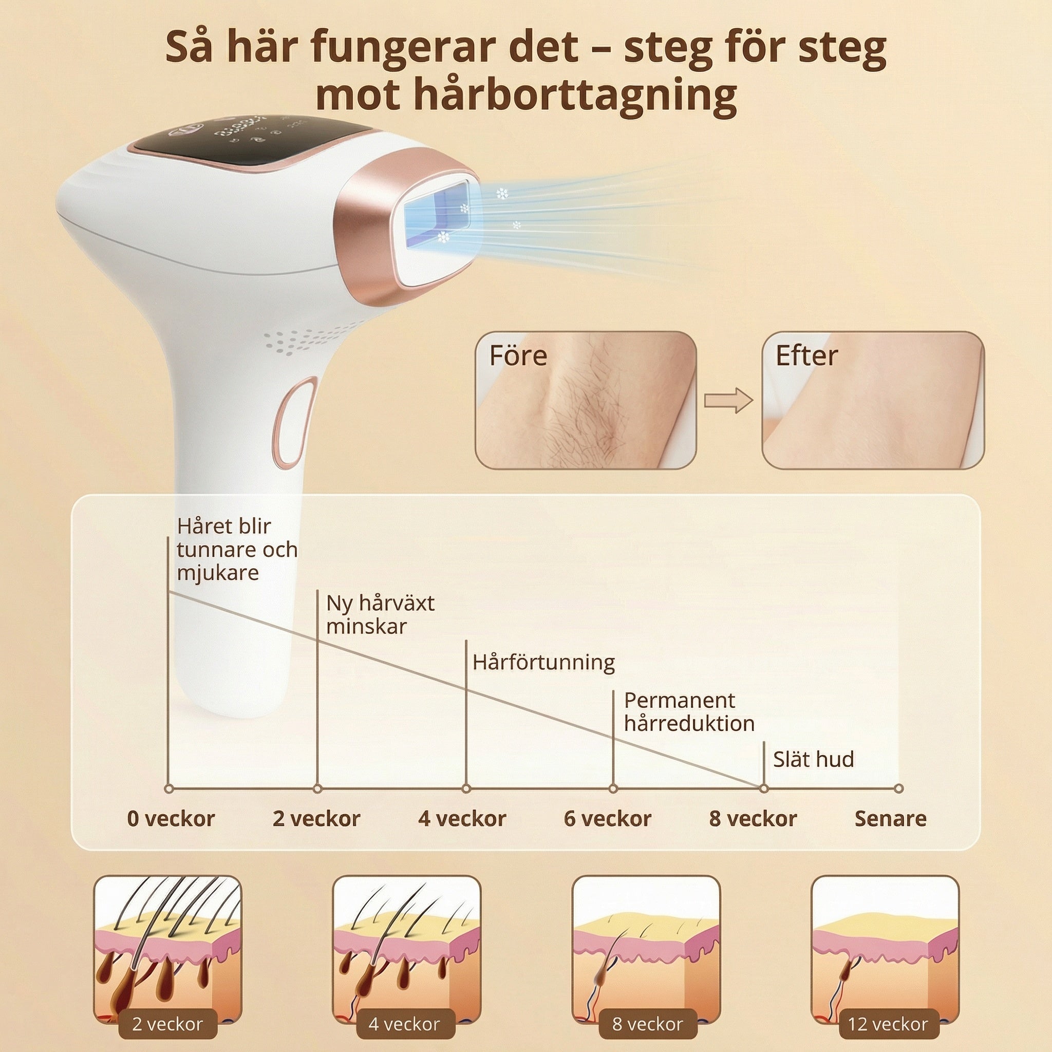 Så fungerar IPL hårborttagning steg för steg